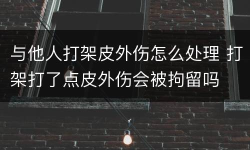 与他人打架皮外伤怎么处理 打架打了点皮外伤会被拘留吗