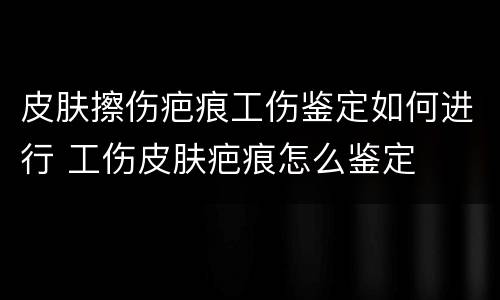 皮肤擦伤疤痕工伤鉴定如何进行 工伤皮肤疤痕怎么鉴定
