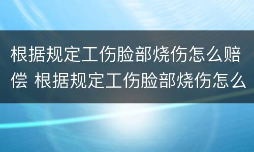 根据规定工伤脸部烧伤怎么赔偿 根据规定工伤脸部烧伤怎么赔偿的
